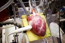 قلب های تولید شده در آزمایشگاه می توانند به درک بیشتر بیماری های ژنتیکی قلبی کمک کنند