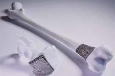 تولید استخوان با استفاده از پرینتر سه بعدی