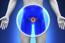 کشف فرایندی که منجر به متاستاز سرطان پروستات می شود