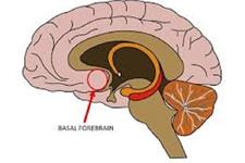 یافتن مکانیسم پشت پرده تشکیل اسکار در سیستم عصبی مرکزی
