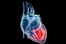 استفاده از تکه های قلبی مهندسی شده سازش پذیر و چهار بعدی برای درمان انفارکته میوکاردی