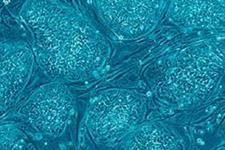 نانوفیبرهای سیلک الکتروریسی شده پتانسیل تمایزی سلول های بنیادی پرتوان القایی انسانی به سلول های تولید کننده انسولین
