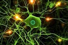 نقش پاسخ های زمان بندی شده سلول های میلوئید در آسیب و ترمیم بعد از آسیب مغزی عروقی