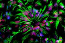 شبکه های عصبی می توانند تمایز شبکیه را در ارگانوئیدهای شبکیه پیش بینی کنند