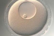 بازیابی کیفیت تخمک ها در تلاش برای مقابله با ناباروری