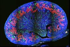 مدل های مغزی آزمایشگاهی(Brain in a dish) مطالعه تکوین عصبی و بیماری های عصبی را آسان می کند