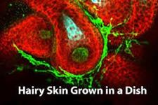 مدل سلولی پوست انسانی مو دار رشد یافته در آزمایشگاه می تواند به تحقیقات در زمینه طاسی کمک کند