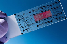 فناوری تولید اندام روی تراشه برای درمان اندومتریوز