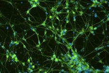 تنظیم عملکرد میکروگلیا توسط سلول‌های بنیادی عصبی 