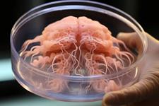 تولید ارگانوئیدهای مغز انسانی فاقد سلول‌های حیوانی 