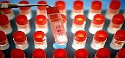آزمایشات بالینی بانک سلول های بنیادی خون بند ناف راه اندازی خواهد شد
