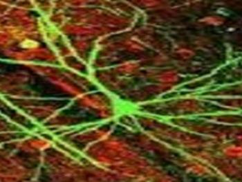 تولید سلول های عصبی القایی مغز از پوست 