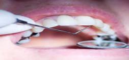سلول های بنیادی دندان به عنوان هدف درمانی جدید