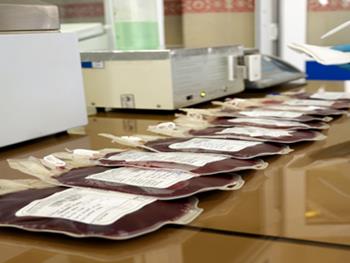 جمع‌آوری خون بندناف اهدایی در بیمارستان‌ها محدود شد