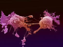 کشف منبع انرژی جدیدی برای سلول های سرطانی