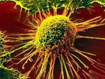 روش های جدید ایمنی درمانی برای تومورهای جامد 