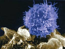 سلول های ایمنی خود فرد بیمار که به طور ژنتیکی تغییر کرده اند برای مبارزه با سرطان خون امیدوارکننده نشان داده اند