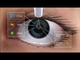 نانو دارو برای خشکی چشم، کمک رسانی با مشکلات کمتر