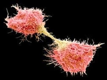 آنتی بادی که پروتئینی را روی سطح سلول های بنیادی هدف قرار می دهد، پروتئینی مشابه را نیز روی سلول های سرطانی هدف قرار می دهد