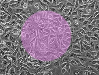 میکروسکوپ Spinning-prism به جمع آوری سلول های بنیادی برای طب بازساختی کمک می کند