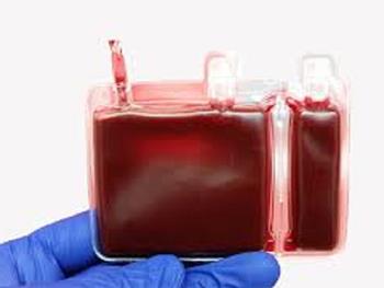 کارآزمایی های بالینی حاکی از موثر بودن خون بند ناف برای درمان سکته است