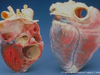 محیط سلول های قلبی یک فاکتور بسیار مهم در بیماری های قلبی است
