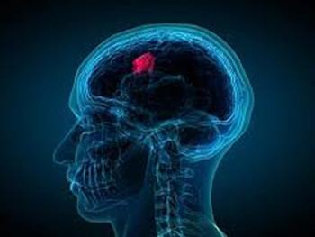 درک بهتر زیست شناسی تومورهای مغزی می تواند منجر به ایجاد درمان های جدید شود