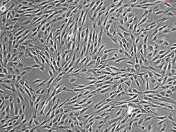 سلول های بنیادی مزانشیمی: نقش حیاتی در ترمیم اندام های آسیب دیده