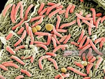 پیوند میکروبیوم مدفوع به احیای باکتری های سودمند در بیماران سرطانی کمک می کند