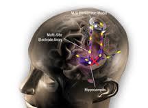 ‌شبیه سازی ناحیه های مختلف مغز روی چیپ