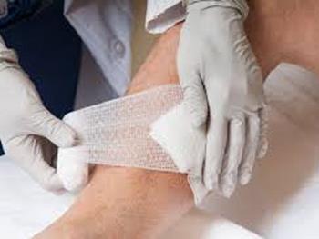 یک زخم پوشش(پانسمان) مبتنی بر میدان الکتریکی برای کمک به بهبود عفونت های زخم