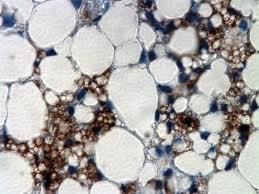سلول های استرومایی بافت چربی به عنوان جایگزینی برای سلول های بنیادی مزانشیمی برای هپاتیت