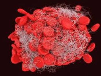 شناسایی جهش هایی بر سر راه بلوغ سلول های خونی سالم