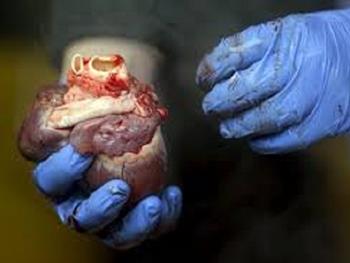 سیاهرگ های باقی مانده از جراحی های قلب منبعی برای سلول های بنیادی