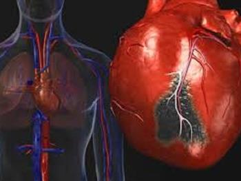 حمله قلبی: تولید جایگزین های عضلانی به لطف سلول های بنیادی
