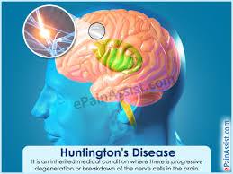 احیای عملکرد نورونی از دست رفته به دلیل هانتینگتون بوسیله سلول های بنیادی