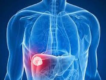 یک داروی ضد رد پیوند شایع می تواند برای درمان برخی از سرطان های کبدی استفاده شود