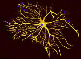 ارتباط آستروسیت های مغزی با بیماری آلزایمر
