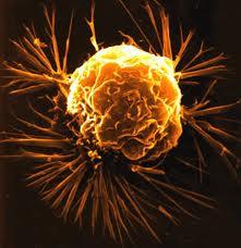 نشانگر مولکولی در بافت های سالم برای پیش بینی خطر ابتلا به سرطان سینه 