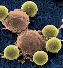 چرا سلول های بنیادی سرطانی نامیرا هستند