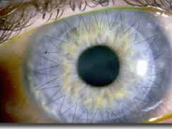 ایجاد درمانی که بینایی را طی عفونت ها یا تروماهای چشمی نجات می دهد