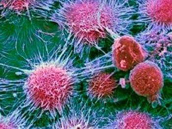 ترکیب دارویی جدیدی که می تواند ریشه سلول های بنیادی سرطانی را تخریب کند
