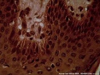 پتانسیل سلول های بنیادی فولیکول مو در ترمیم نورون های آسیب دیده
