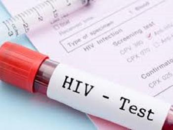 گیرنده معیوب ایمنی می تواند دلیلی برای مشکلات مربوط به HIV باشد