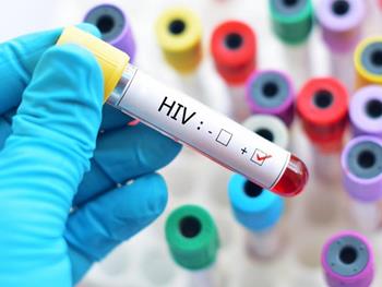 حذف ویروس ایدز(HIV) از ژنوم موجودات زنده