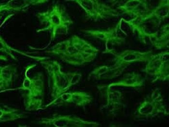 چگونه سلول های گلیالی مغز از سلول های پیش ساز عصبی تکوین می یابند