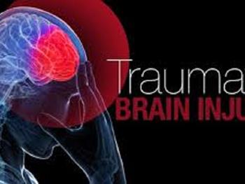 شبیه سازی اثرات آسیب ترومایی مغز در ظروف آزمایشگاهی