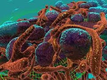 سلول های سرطانی در بافت های سفت رشد می کنند