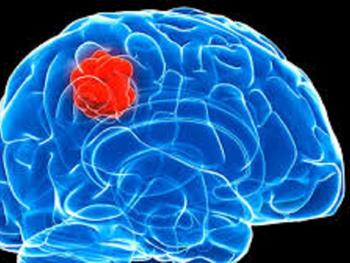 وضعیت متابولیکی سلول های بنیادی سرطان مغز با سلول های سرطانی که آن ها تولید می کنند تفاوت چشمگیری دارد