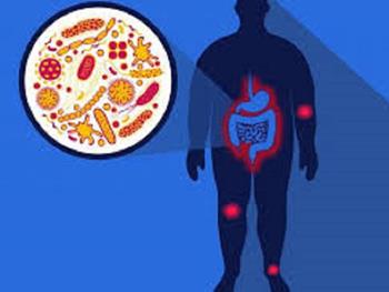پاسخ های ایمنی ذاتی به رژیم غذایی پر چربی منجر به چاقی می شود